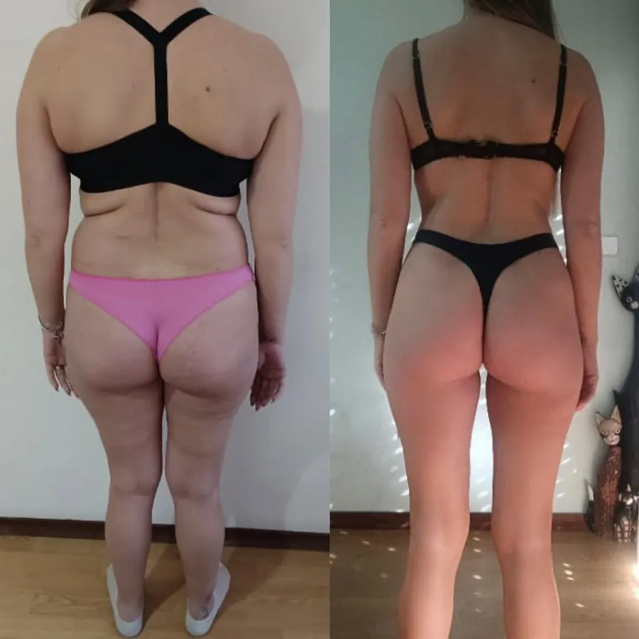 Antes e depois 1
