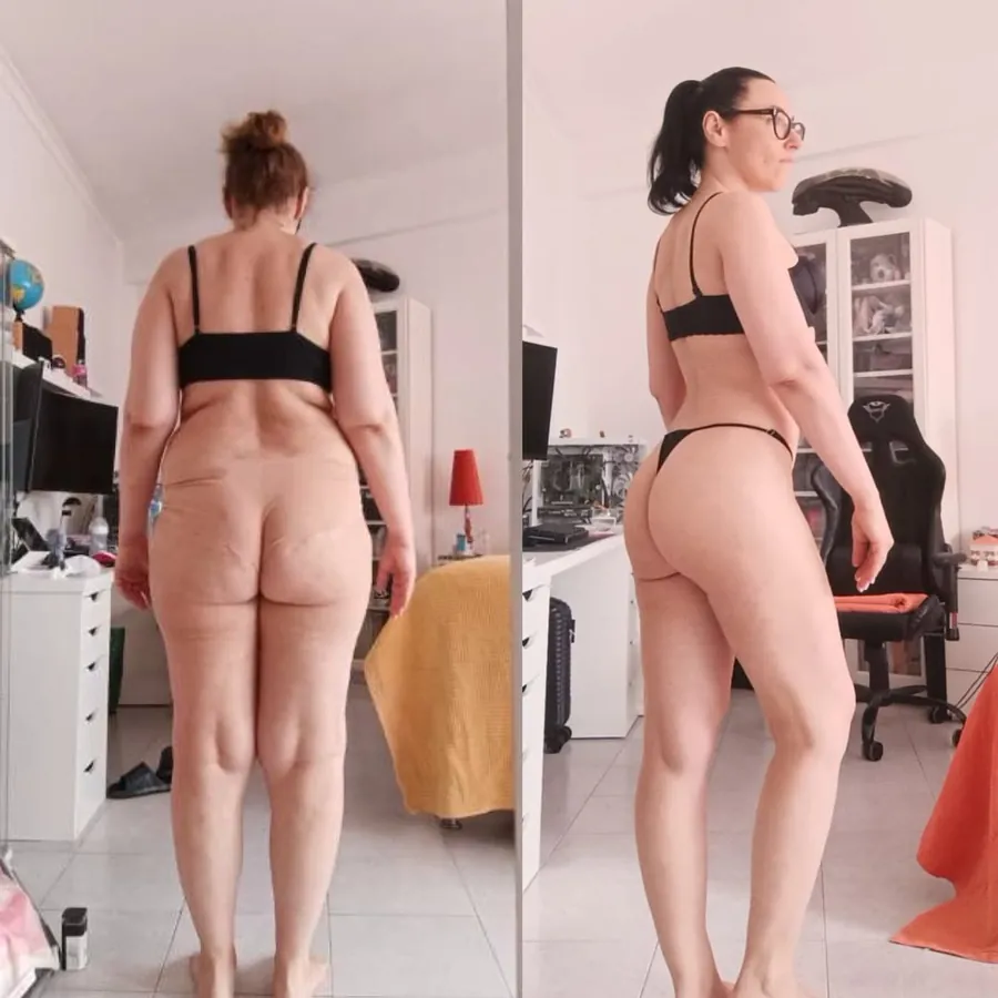 Antes e depois 3