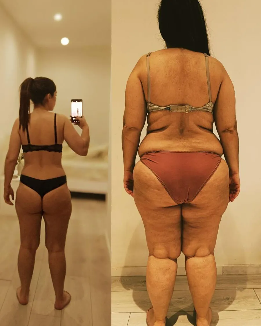 Antes e depois 4