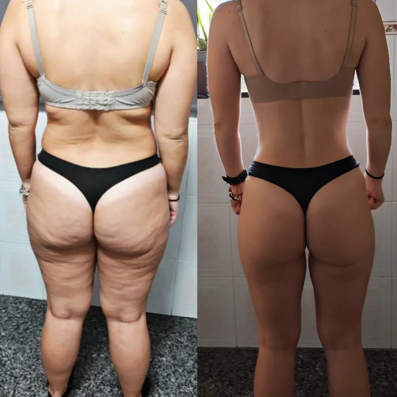 Antes e depois 5