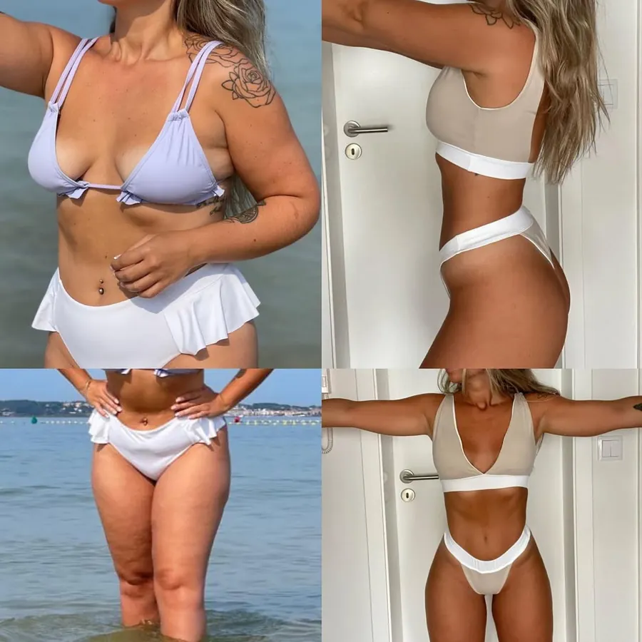 Antes e depois 7