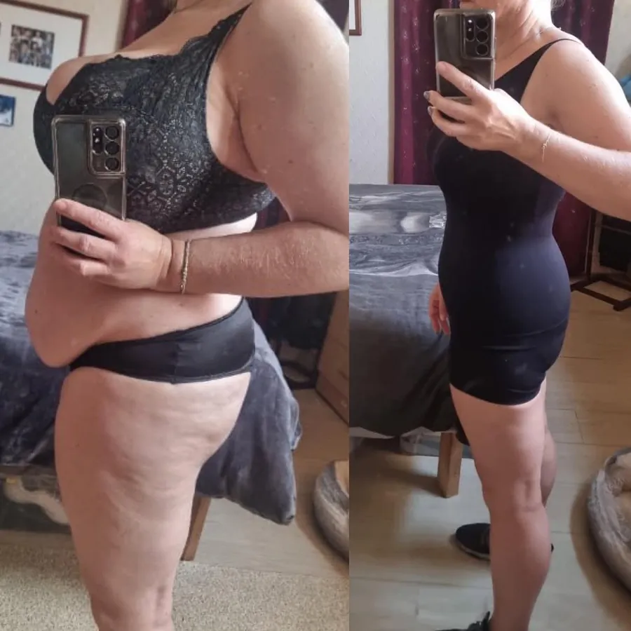 Antes e depois 8